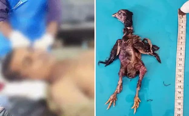 בלע תרנגולת - ומת מוות אכזרי